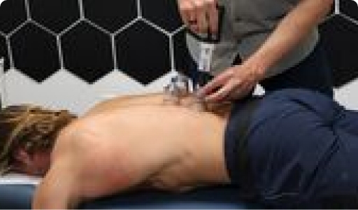 doctor using vacuum cup to relieve muscles